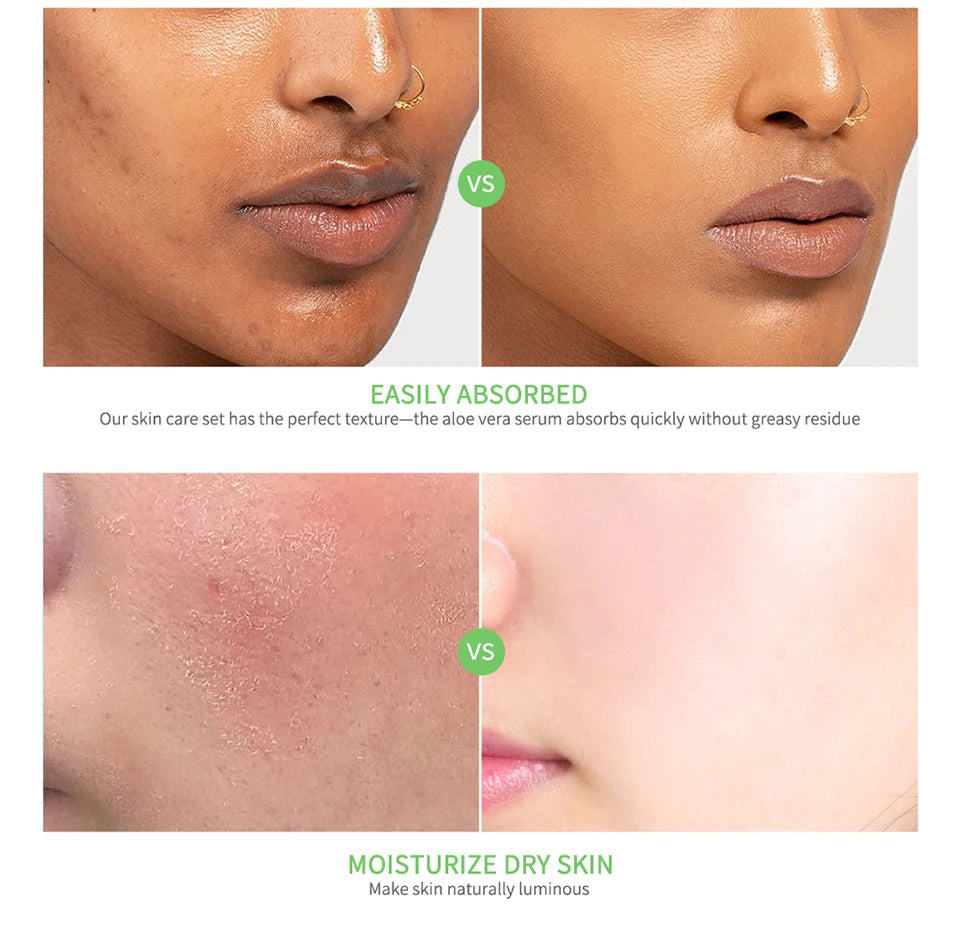 Skin Care Set