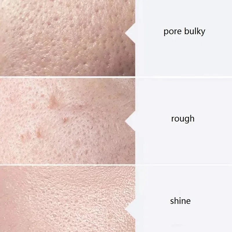 Face Serum