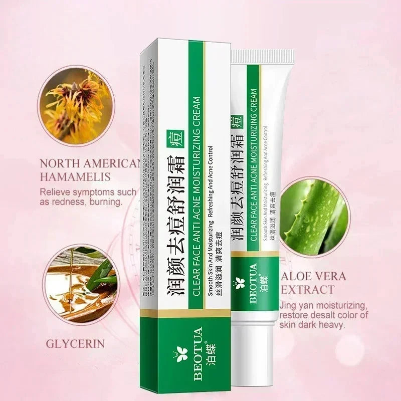 Acne Treatment Face Cream