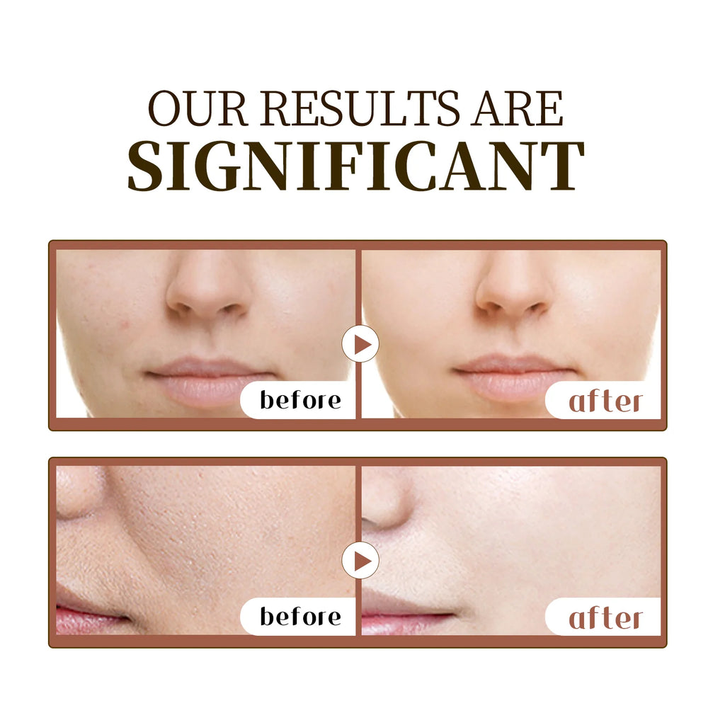Face Serum
