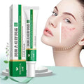 Acne Treatment Face Cream